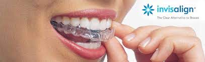 Invisalign